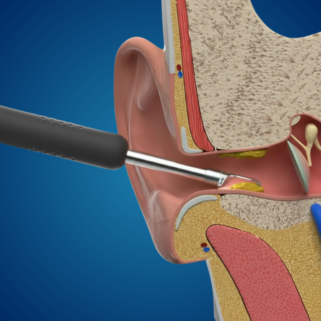 CENSUR Bebird R1 - White